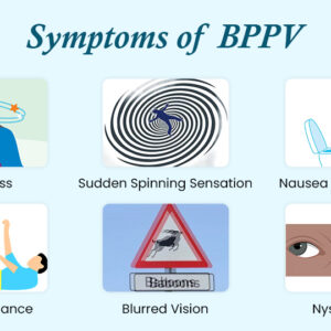 BPPV