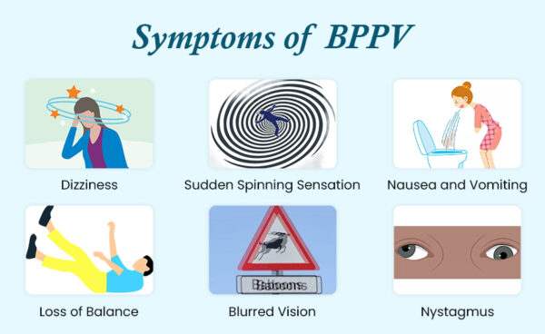 BPPV